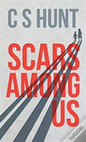 Scars Among Us