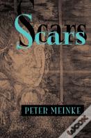 Scars