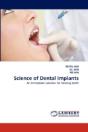 Science Of Dental Implants - Preview
