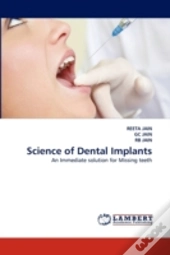 Science Of Dental Implants