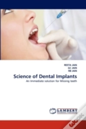 Capa do artigo Science Of Dental Implants