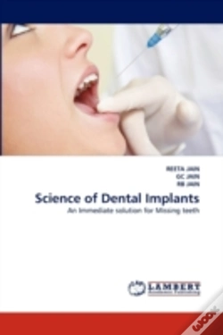 Capa do artigo Science Of Dental Implants