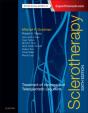 Sclerotherapy - Preview