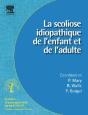 Scoliose Idiopathique De L'Enfant Et De L'Adulte - Preview