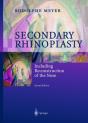 Secondary Rhinoplasty - Preview