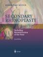Secondary Rhinoplasty - Preview