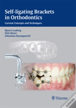 Capa do artigo Self-Ligating Brackets In Orthodontics