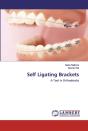 Self Ligating Brackets - Preview