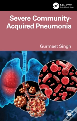 Capa do artigo Severe Community-Acquired Pneumonia