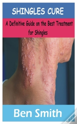 Capa do artigo Shingles Cure