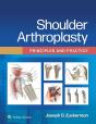 Shoulder Arthroplasty - Preview