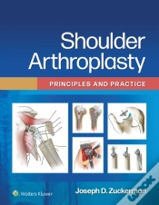 Capa do artigo Shoulder Arthroplasty