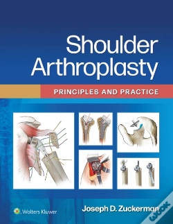 Capa do artigo Shoulder Arthroplasty