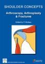 Shoulder Concepts Arthroscopy Arthrosplasty & Fractures - Preview