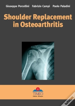 Capa do artigo Shoulder Replacement In Osteoarthritis