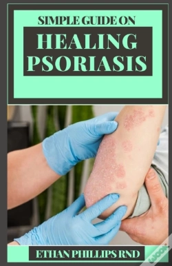 Capa do artigo Simple Guide On Healing Psoriasis