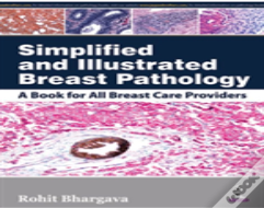 Simplified And Illustrated Breast Pathology