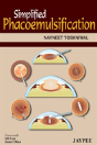 Simplified Phacoemulsification - Preview