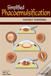 Simplified Phacoemulsification