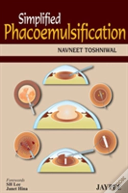 Capa do artigo Simplified Phacoemulsification