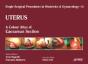 Single Surgical Procedures In Obstetrics And Gynaecology - Volume 14 - Uterus - Preview