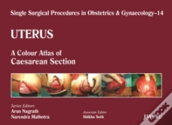 Capa do artigo Single Surgical Procedures In Obstetrics And Gynaecology - Volume 14 - Uterus