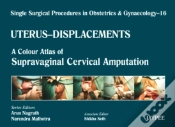 Capa do artigo Single Surgical Procedures In Obstetrics And Gynaecology - Volume 16 - Uterus - Displacements