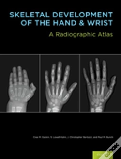 Capa do artigo Skeletal Development Of The Hand And Wrist