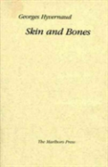 Skin And Bones