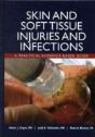 Skin And Soft Tissue Injuries And Infections: A Practical Evidence Based Guide - Preview