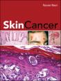 Skin Cancer - Preview