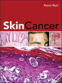 Capa do artigo Skin Cancer