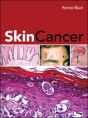 SKIN CANCER - Preview