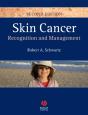 Skin Cancer - Preview
