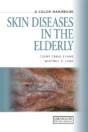 Skin Diseases In The Elderly - Preview