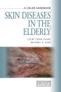 Skin Diseases In The Elderly - Preview