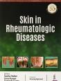 Skin In Rheumatologic Diseases - Preview