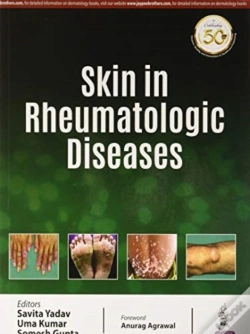 Capa do artigo Skin In Rheumatologic Diseases