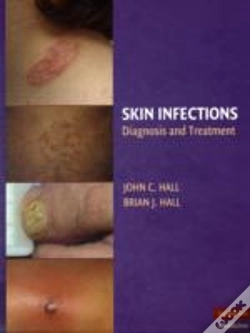 Capa do artigo Skin Infections