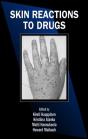 Skin Reactions To Drugs - Preview