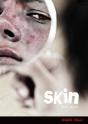 Skin - Preview