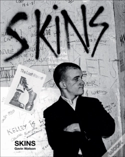 Capa do artigo Skins - Special Edition