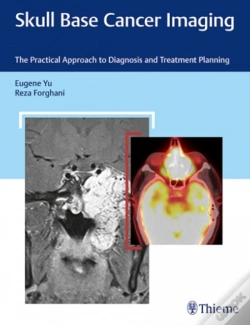 Capa do artigo Skull Base Cancer Imaging