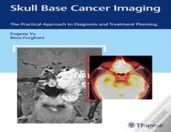 Skull Base Cancer Imaging
