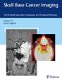 Skull Base Cancer Imaging - Preview
