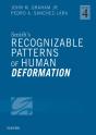 Smith'S Recognizable Patterns Of Human Deformation E-Book - Preview
