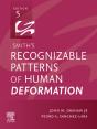 Smith'S Recognizable Patterns Of Human Deformation E-Book - Preview
