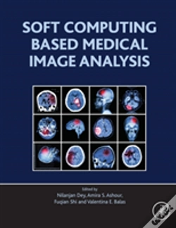Capa do artigo Soft Computing Based Medical Image Analysis