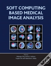 Soft Computing Based Medical Image Analysis