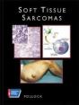 Soft Tissue Sarcomas - Preview